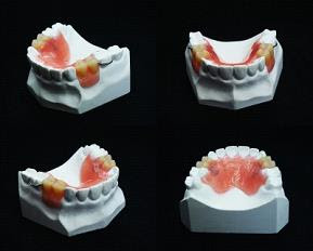 New Teeth Stamford CT - New Teeth One Day